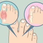 découvrez des astuces efficaces pour ramollir les ongles de vos pieds durs et rêche. apprenez à prendre soin de vos pieds avec des conseils pratiques pour assouplir vos ongles et améliorer votre bien-être. transformez vos pieds en un atout de beauté !